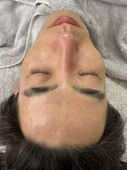 リコリス(Lycoris)/毛穴洗浄