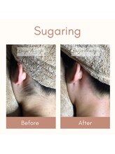 ベイジョ デ アンジョ(Beijo de anjo)/うなじシュガーリング