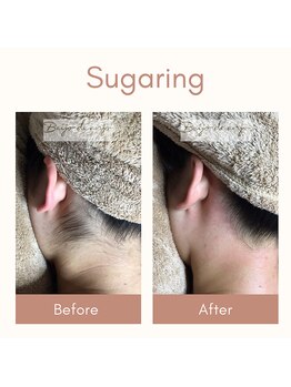 ベイジョ デ アンジョ(Beijo de anjo)/うなじシュガーリング