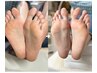 【yurino限定クーポン】フット角質ケア！指周りケア込¥4,400-→¥3,300-