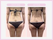 スリムライン 盛岡店(The Slim Line)/before→after