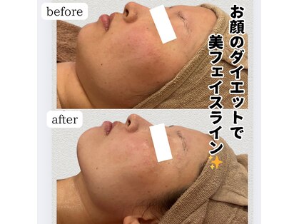 カリス(charis)の写真