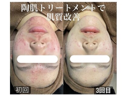 フウカ(FUUKA)の写真