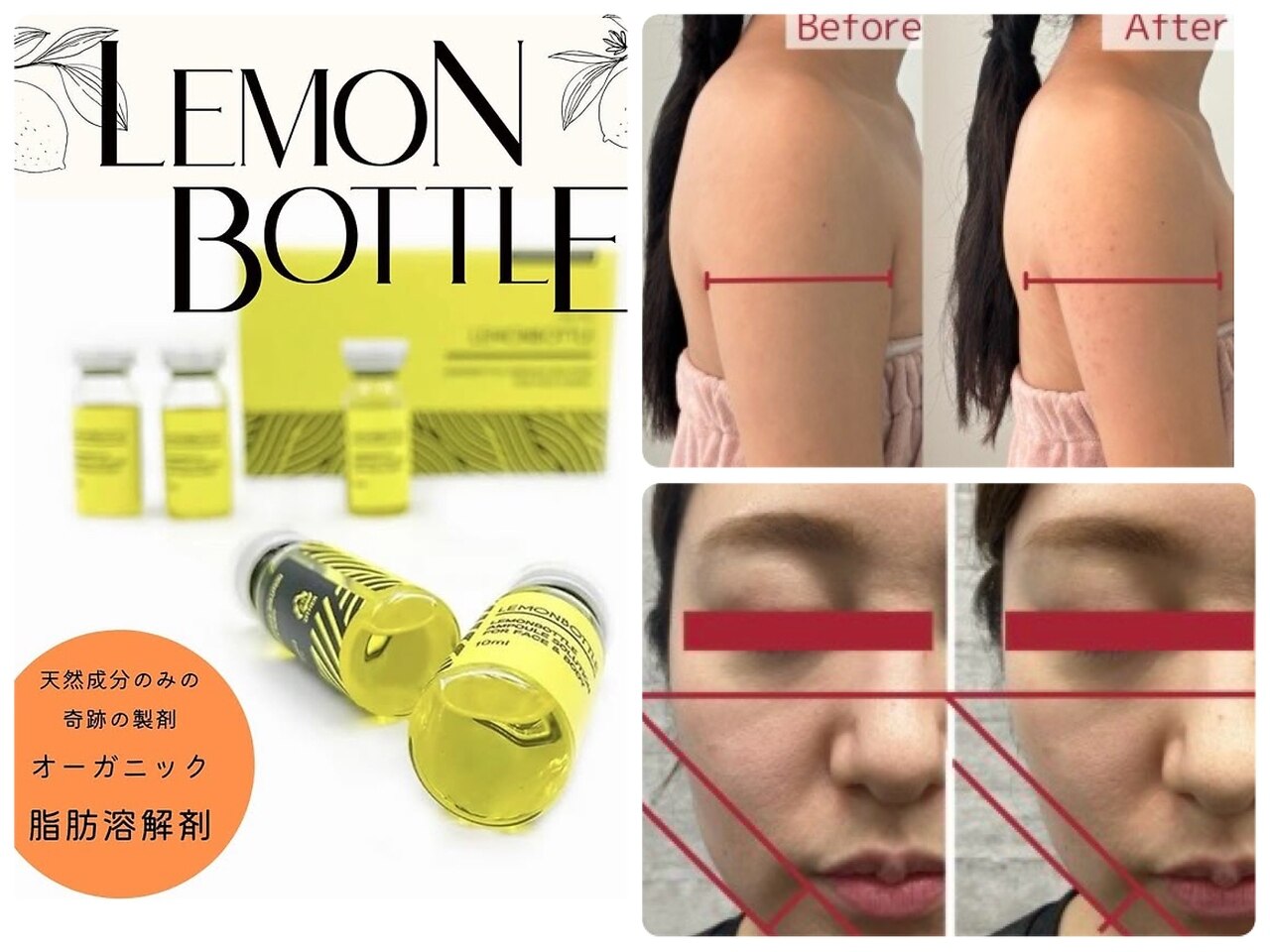 9ページ目｜大阪府でEMSが人気のエステサロン｜ホットペッパービューティー