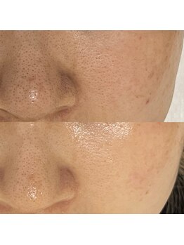 Mirai【毛穴/ハーブピーリング/エイジングケア/頭皮ケア】【3/1 NEW OPEN (予定)】/韓国三冠！セラピール