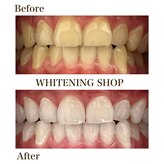 ホワイトニングショップ 尾道店(WHITENING SHOP)