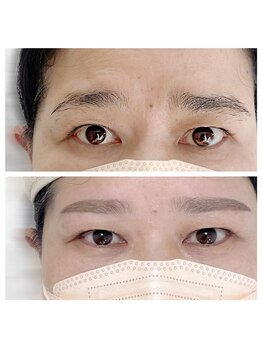 アッピーラッシュ(Appy.Lash)/メンズ眉毛