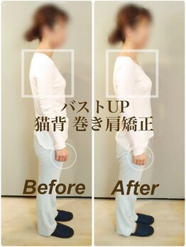 ティーエスエル とがし整体ラボ(TSL とがし整体 Labo)/ブライダル整体/骨盤矯正/反り腰