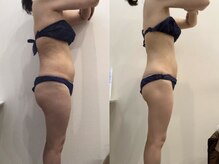 ビラ 銀座店(BILA)/キャビラジ