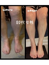 ニコ(niko)/リフレ（一回の施術）