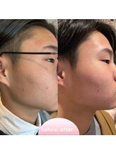 ミュー 植田店(mieux)/◆ビフォーアフター