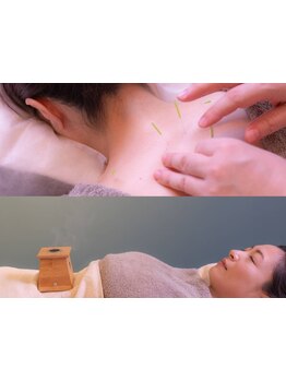 鍼灸施術を受けたい