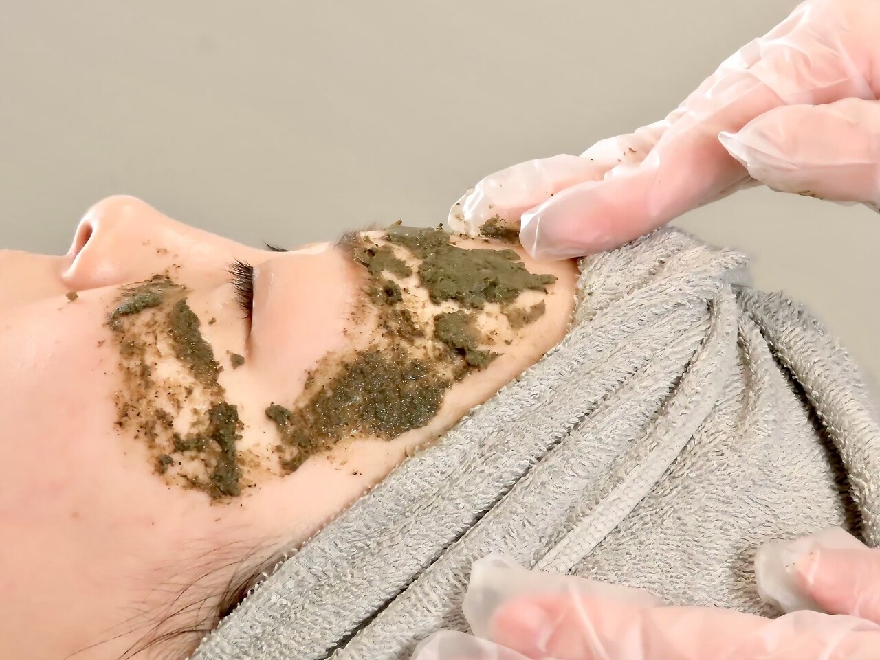 期間限定☆【次世代ハーブピーリング×ペプチド導入】ニキビケア跡ケア・毛穴