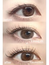 ブライズ(BRISE)/リフエク