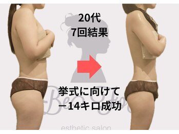 ビーフォー(be for)/大切な日に向けて♪