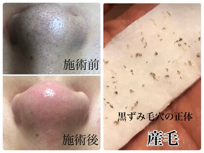 デアマリスの写真