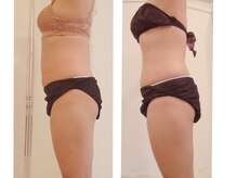 ケイ(K)/【防府】サイズダウンしたい