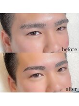 ダリ(Dali)/メンズハリウッドブロウリフト