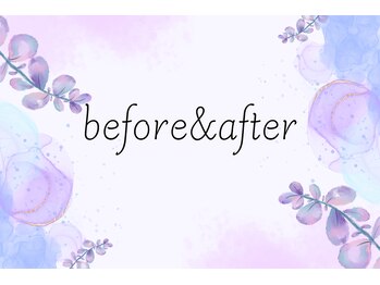 ルピナージュ(Lupinage)/フェイシャルーbefore&afterー