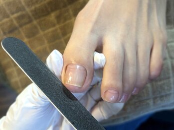 ネイルカフェ ナナ(nailcafe'nana)の写真/《本格フットケア》どこに行っても中々改善できない分厚い爪・巻き爪の方…足のお悩みを改善しませんか？