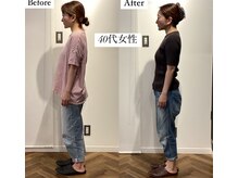 コルミチョン サロン(骨美整 salon)/40代女性　Before・After