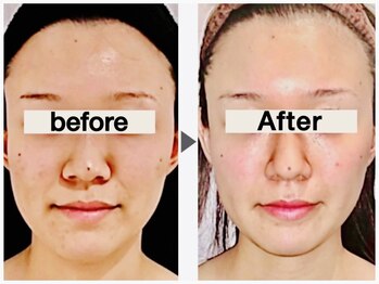 小顔整体研究所 KSラボ 金沢長坂店