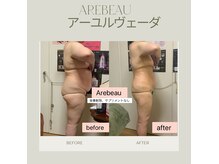 アレビュー(Arebeau)の雰囲気（いつまでも若さを纏う健康美/エイジングケア/太りにくい体型☆）