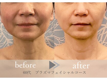 グロッシー(glossy)の写真