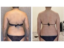 TMサロン 赤坂/体は年齢で変わるんじゃない