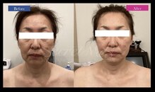 ティアレソワン(tiare soin)