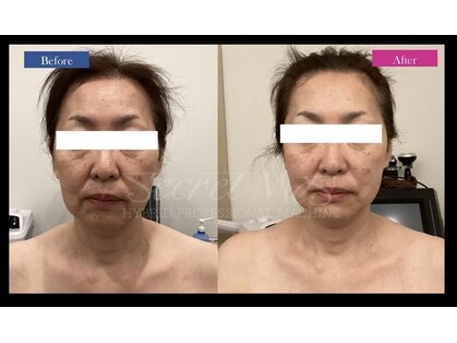 ティアレソワン(tiare soin)の写真