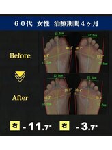 サラ(SARA)/