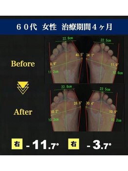 サラ(SARA)/