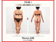 ムーン 高崎店(MOON)の雰囲気（セルゼロ痩身）