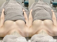 ティアモ(Ti Amo)/Before/After