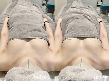 ティアモ(Ti Amo)/Before/After