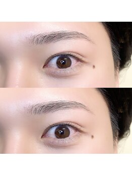 リンネ(LinNe)/KURUMI担当