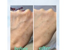 ルミヌーズ(Lumineuse)/若よもぎ蒸し「美」