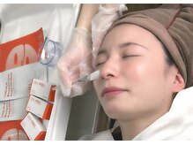 韓国女優の肌管理☆美容クリニックで同じ施術つやつや水光肌へ