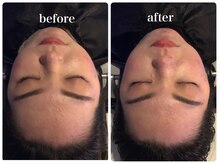 ポノ(PONO)/ビフォーアフター【エアバリ】