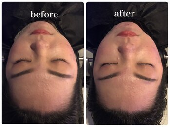 ポノ(PONO)/ビフォーアフター【エアバリ】