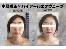 ヴァリエス プライム 中目黒店(VARIES PRIME)の雰囲気（リピート率驚異の98%★芸能人も通う！結果にこだわる小顔矯正）