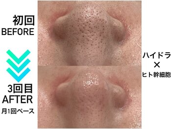 リンフェイス 心斎橋店(RINFACE)