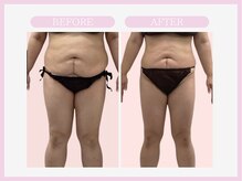 スリムライン 仙台店(The Slim Line)/before→after