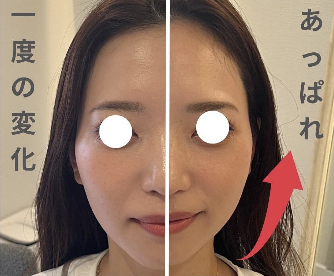 ◾️最終価格◾️はじめての人のための頭蓋骨矯正 はじめての人のための頭蓋骨矯正 | 医療情報研究所 DVD教材ストア