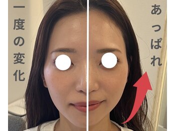 エレミュー(Elemue)