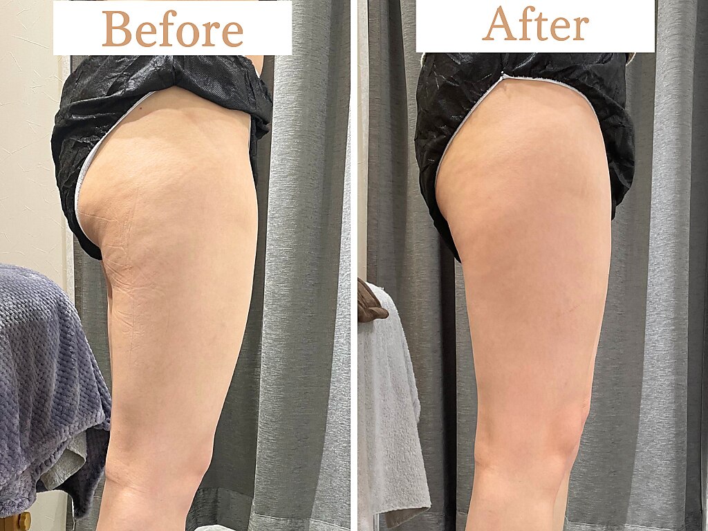 フローフシ∞｜ホットペッパービューティー