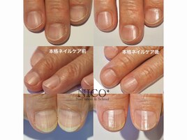 爪育ネイルケア