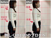 整骨院クリア 五香本院(整骨院Clear)/肩コリの原因は猫背姿勢から