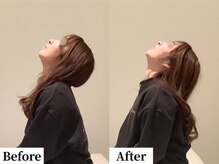 ソレア(Solea)/首こり改善1回目